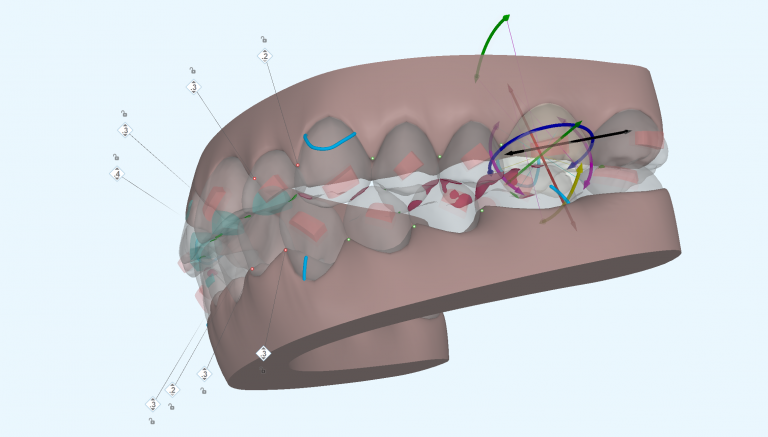 ClinCheck Pro 3D Control