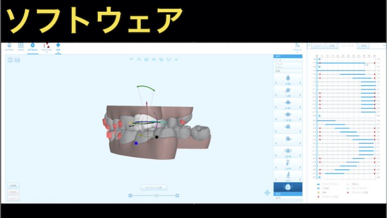 Invisalign の歴史とマウスピース矯正の現在 Oral Powerが世界を変える