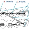 multi bracket