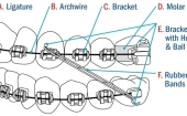 multi bracket